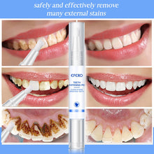 Load image into Gallery viewer, Teeth Whitening Pen